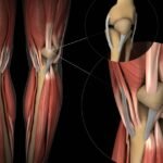 Cartilage Repair Market / Cartilage Regeneration Market