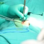 Hernia Repair Market
