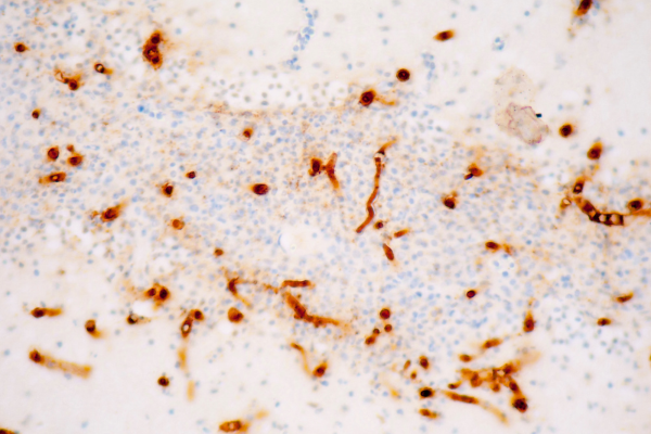 Market forces: driving advances in immunohistochemistry technologies