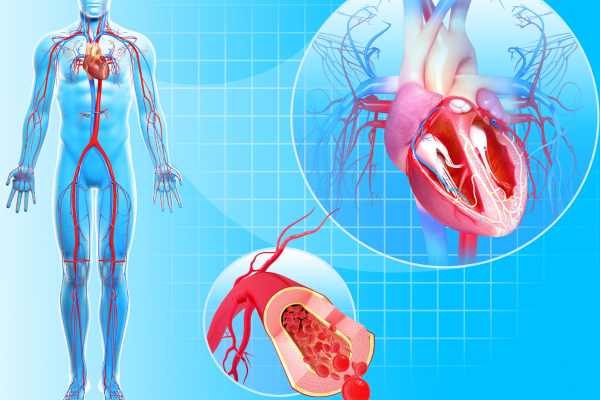 The Role of Cardiovascular Information Systems in Modern Healthcare